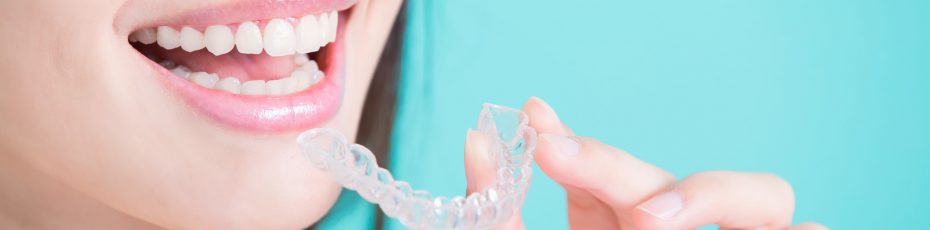 the benefits of Invisalign
