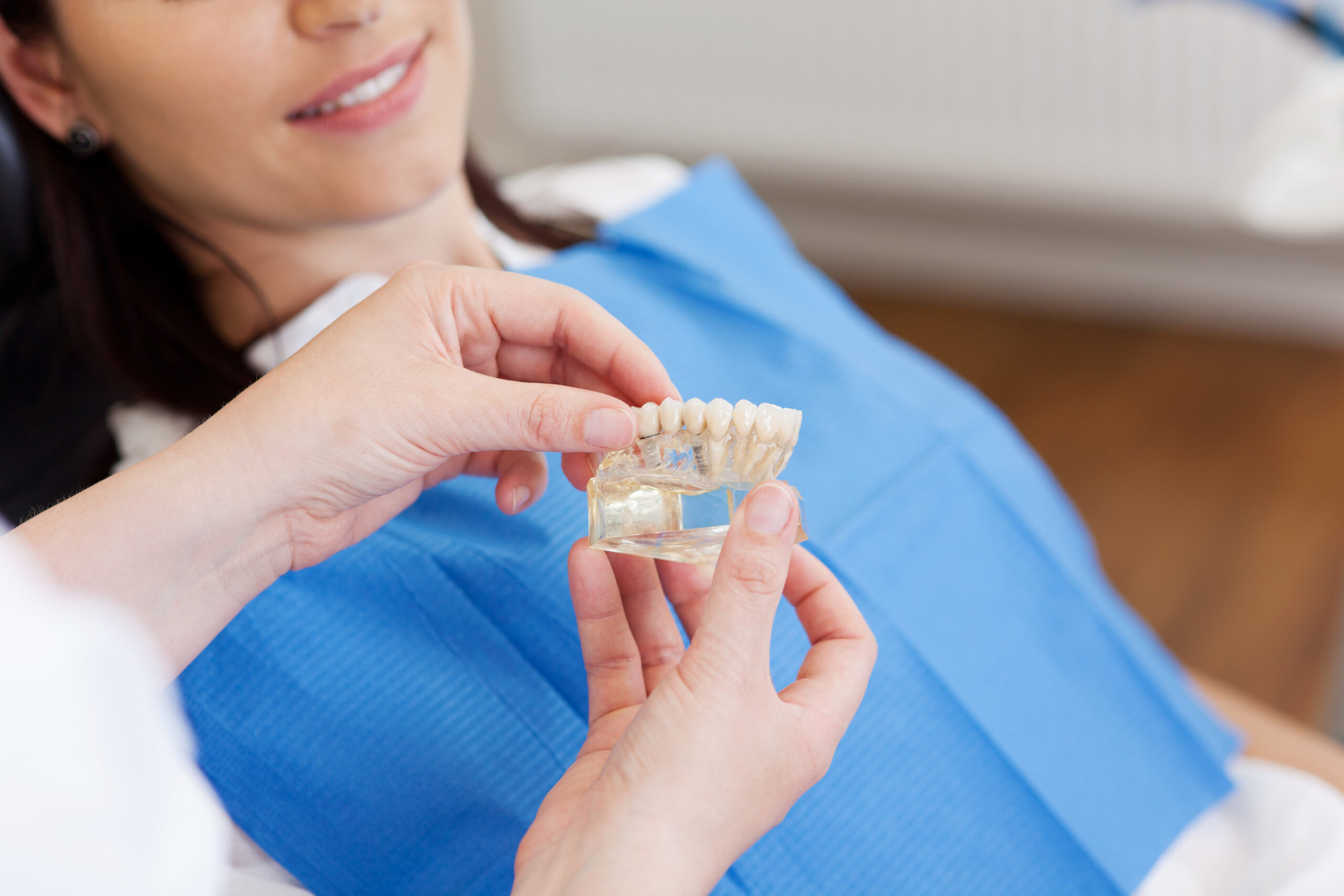 should you get full mouth dental implants