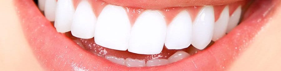 Teeth Whitening Tips