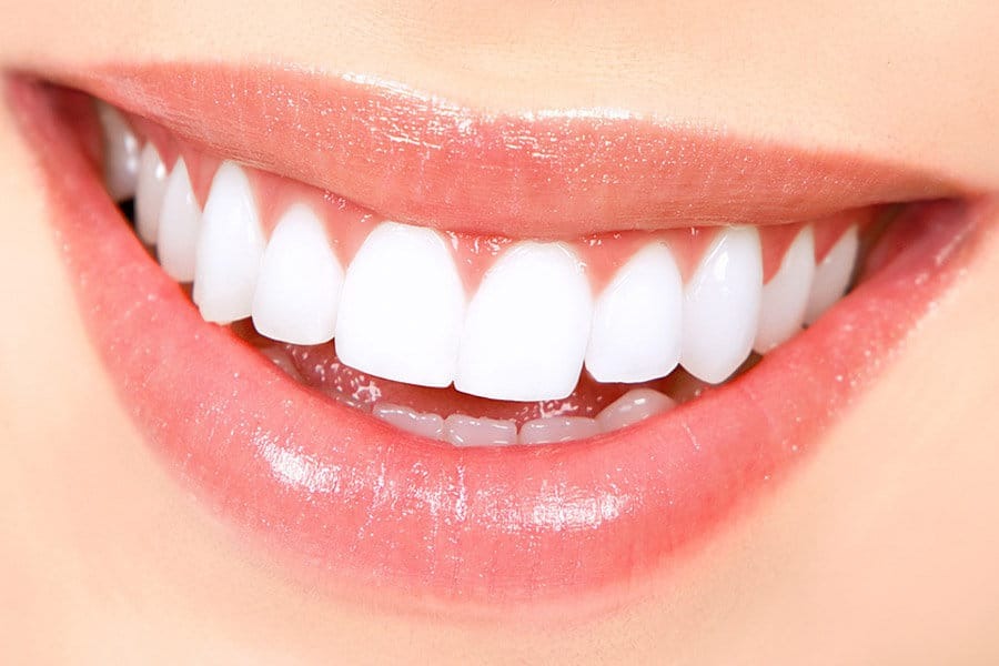 Teeth Whitening Tips