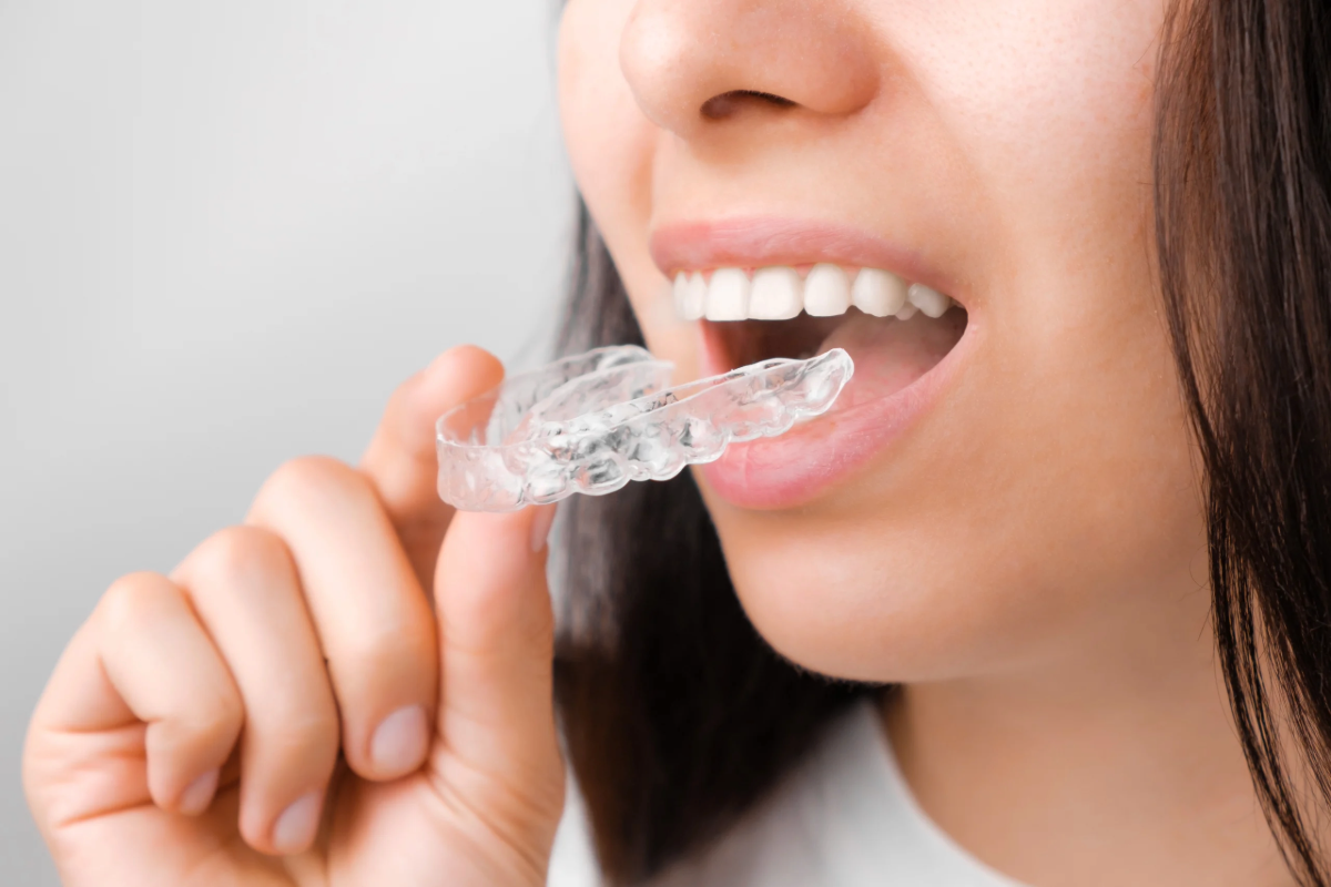 how long does invisalign take to straighten teeth