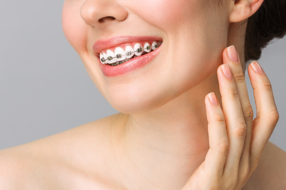 what is the difference between metal braces and clear braces. which is a better option