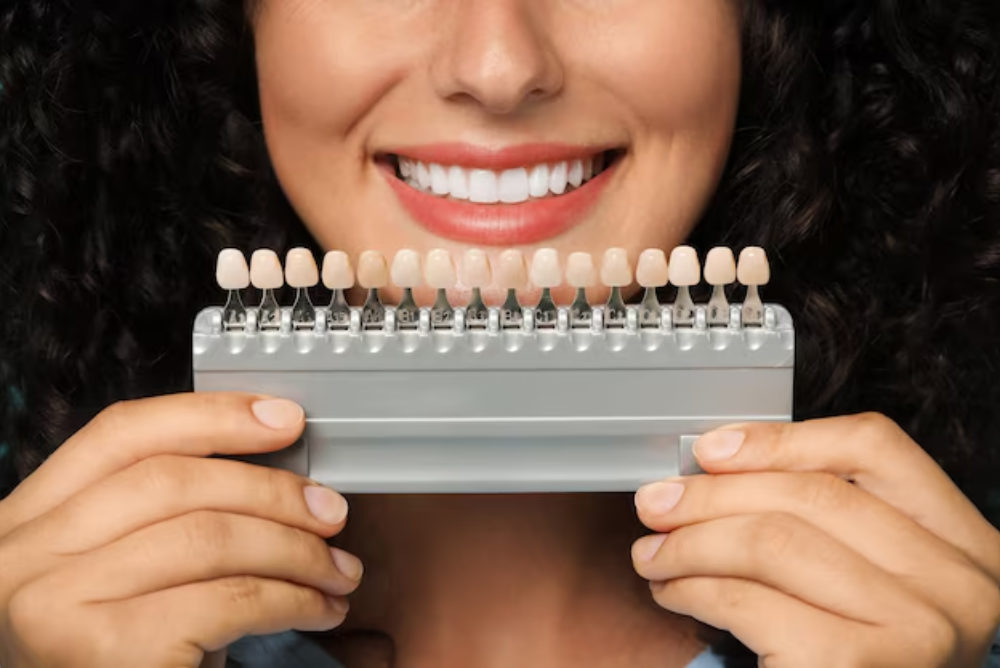 what-are-porcelain-veneers-can-veneers-fix-crooked-or-chipped-teeth